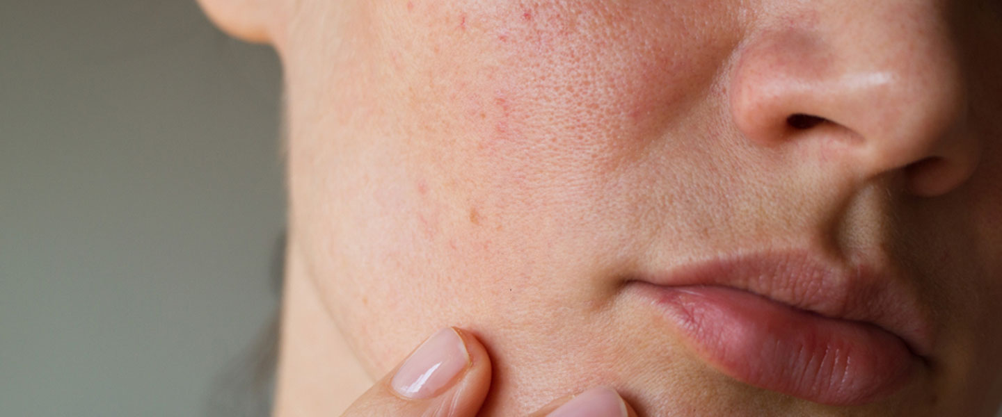 Güneş Işınları, Deri Sağlığı ve Enfeksiyon Direnci: Bilinçli Güneş Kullanımı