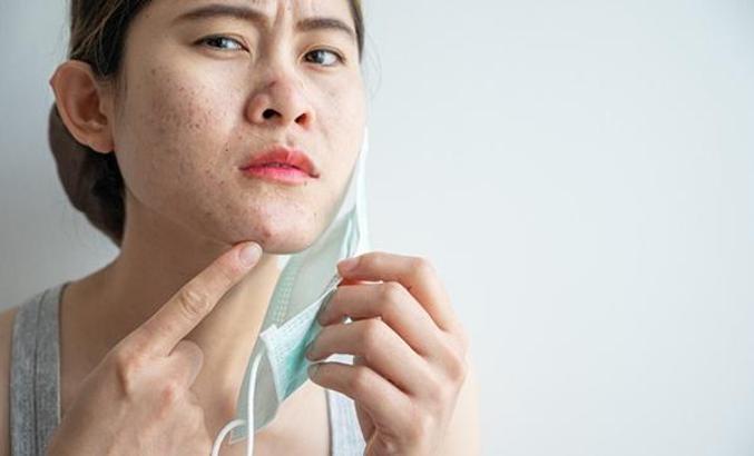 Kış Cilt Bakımında Havalandırma, Doğru Rutin ve Elleri Korumak