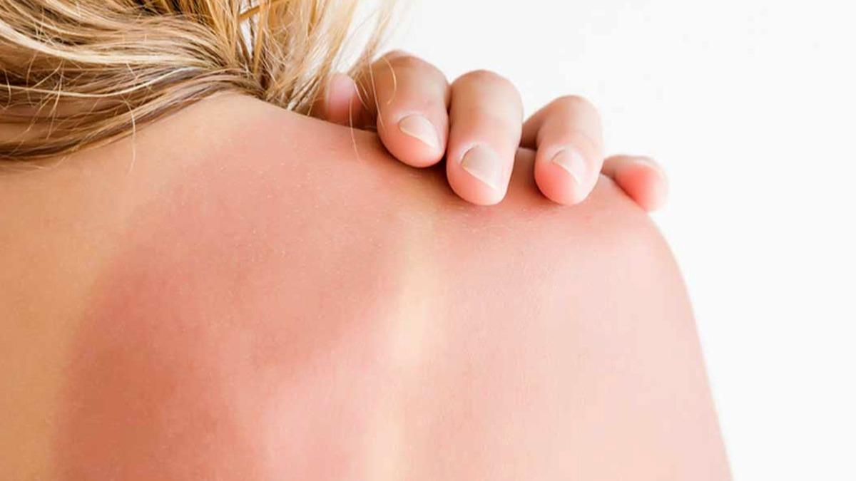 Sarı Kantaron Yağının Faydaları ve Kullanım İpuçları