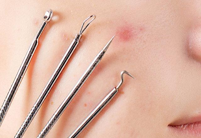 Siyah Noktalarla Mücadelede Doğal ve Etkili Bakımsel Rehber