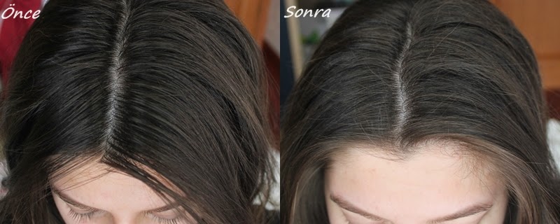 Yağlı Saçlarla Baş Etmenin Pratik Yolları: Günlük Bakım İçin Öne Çıkan İpuçları